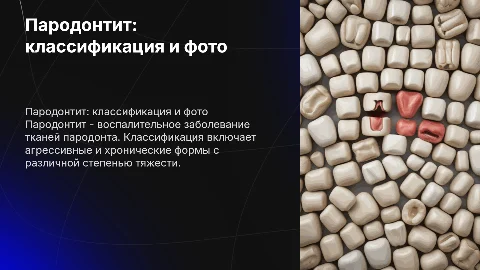 пародонтит. классификация с фото