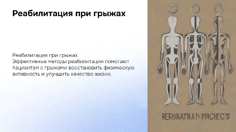 Создание мультимедийной презентации о реабилитации при грыжах