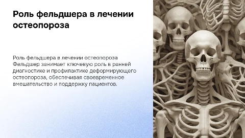 Деятельность фельдшера в лечении остеопороза: ключевые аспекты