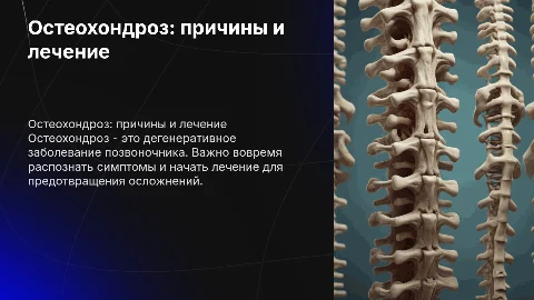 остеохондроз