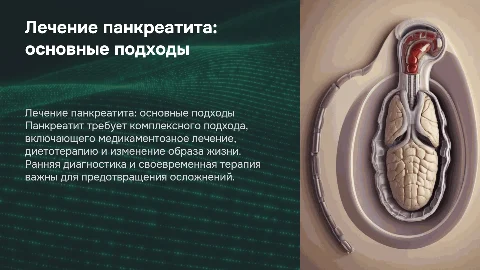 Лечение панкреатита