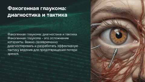 Факогенная глаукома: диагностика и тактика ведения