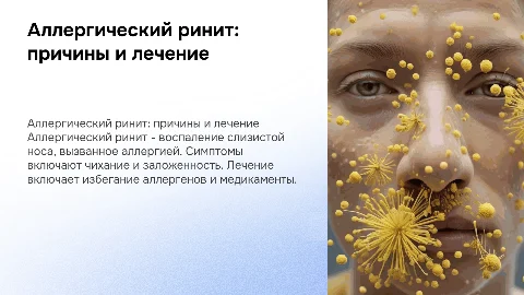 аллергический ринит