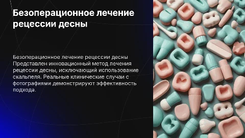 Новый метод лечения рецессии десны без скальпеля