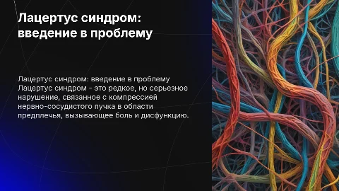 Лацертус синдром