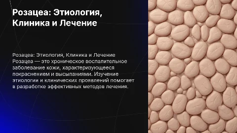 розацеа этиология клиника и лечение