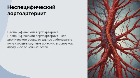 неспецифический аортоартериит