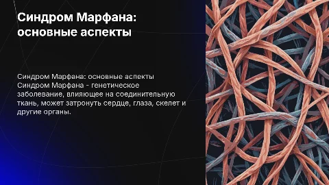 тема синдром марфана