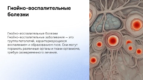 ГНОЙНО-ВОСПАЛИТЕЛЬНЫЕ ЗАБОЛЕВАНИЯ