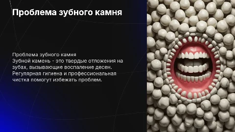 зубной камень