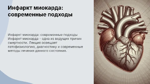 инфаркт миокарда лекция для врачей