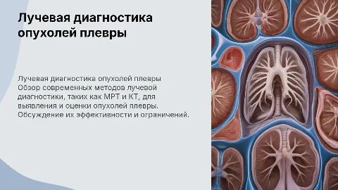Лучевая диагностика опухолей плевры