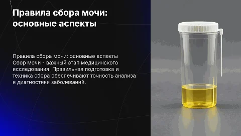 Правила сборки мочи