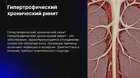 Гипертрофический хронический ринит: диагностика и лечение