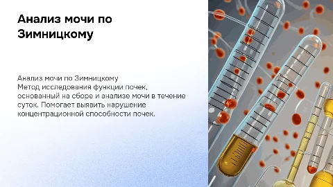 Анализ мочи по Зимницкому