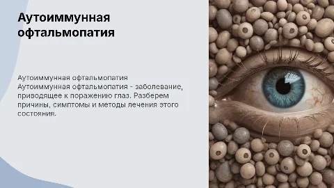 Аутоиммунная офтальмопатия