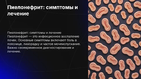 пиелонефрит