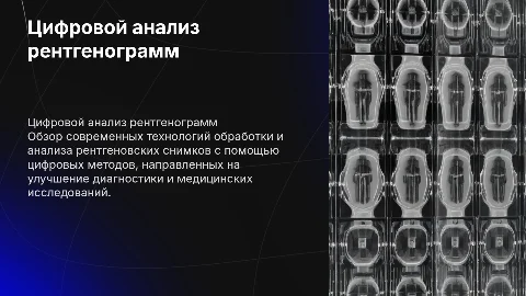 Цифровой анализ рентгенограмм: современные технологии диагностики