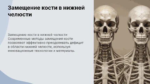 Современные методы замещения кости в нижней челюсти
