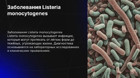 Заболевания, вызванные Listeria monocytogenes: диагностика и лечение