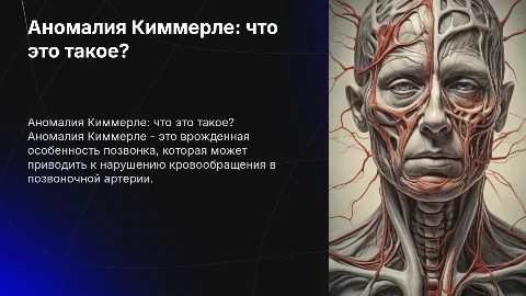 Аномалия Киммерле