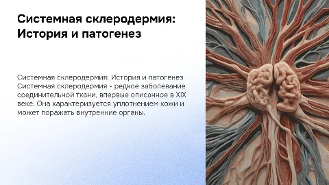 Презентация по системной склеродермии: история и патогенез