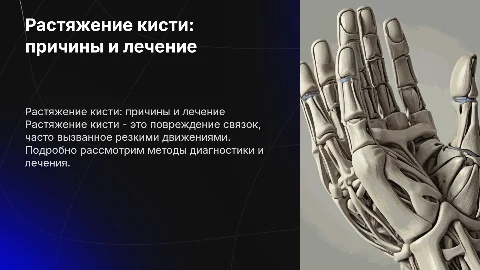 Растяжение кисти