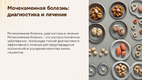 Мочекаменная болезнь, диагностика и лечение
