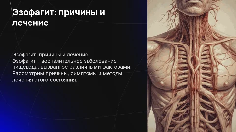 Эзофагит