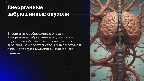 Внеорганные забрюшинные опухоли
