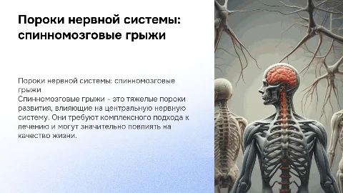 Пороки развития нервной системы-спинномозговые грыжи
