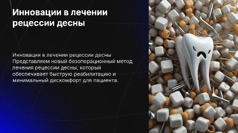 Новый метод лечения рецессии десны без скальпеля