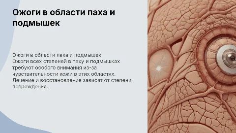 Ожоги всех 4 степеней в области паха и подмышках