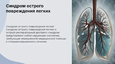 Синдром острого повреждения легких и ОРДС: терапия и характеристики