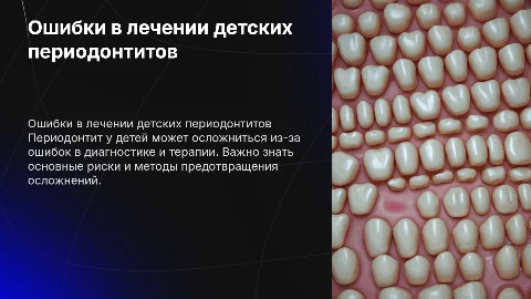 Ошибки и осложнения при лечении периодонтитов у детей