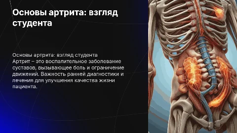 презентация на тему артрит студента медика