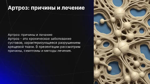 Артроз презентация