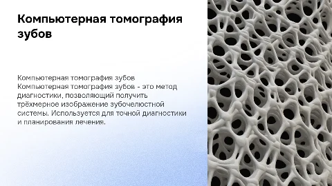 Компьютерная томография зубов