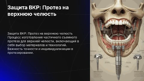 Защита ВКР: Изготовление частичного съемного протеза