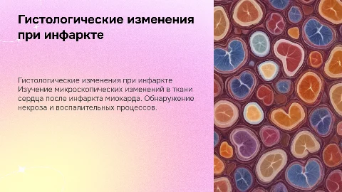 Гистология сердца при инфаркте