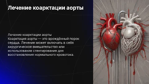 презентация про лечение коарктации аорты