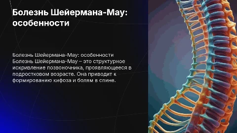 Болезнь Шейермана-Мау