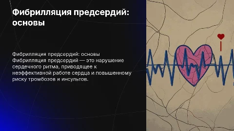 Фибрилляция предсердий