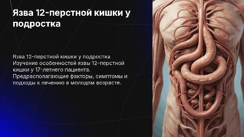 Язва 12-перстной кишки у ребенка 17 лет