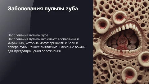 Заболевания пульпы