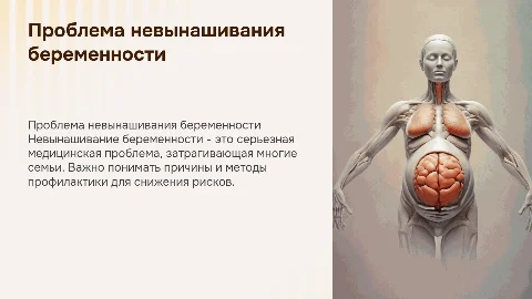 невынашивание беременности