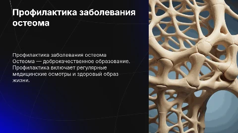 профилактика заболевания остеома