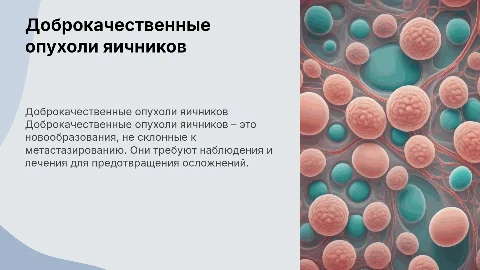 доброкачественные опухоли яичников презентация