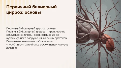 первичный билиарный цирроз