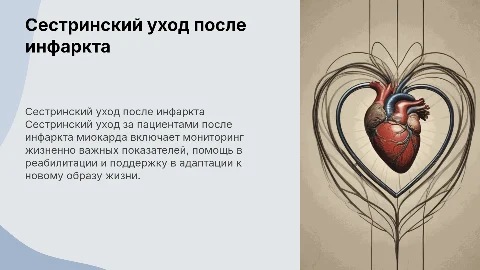 Сестринский уход за пациентом после инфаркта миокарда